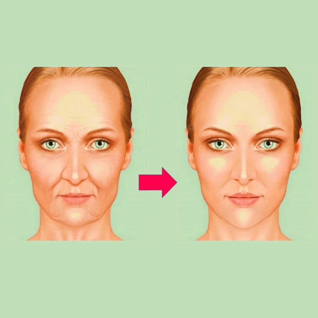 تزریق چربی برای جوان‌سازی پوست